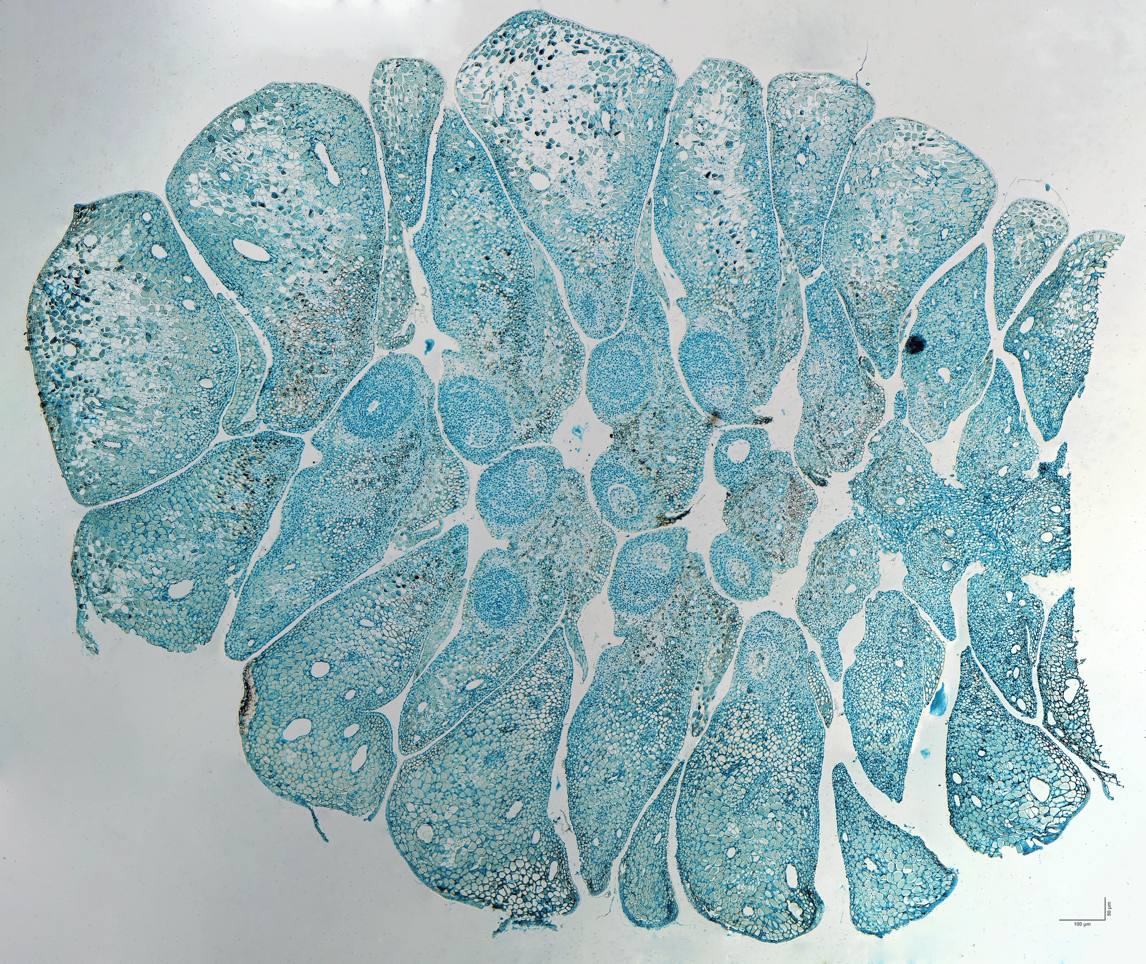 Longitudinal section of a young female pine cone